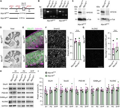 Myosin XVI Regulates Actin Cytoskeleton Dynamics in Dendritic Spines of Purkinje Cells and Affects Presynaptic Organization